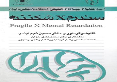 سندرم x شکننده